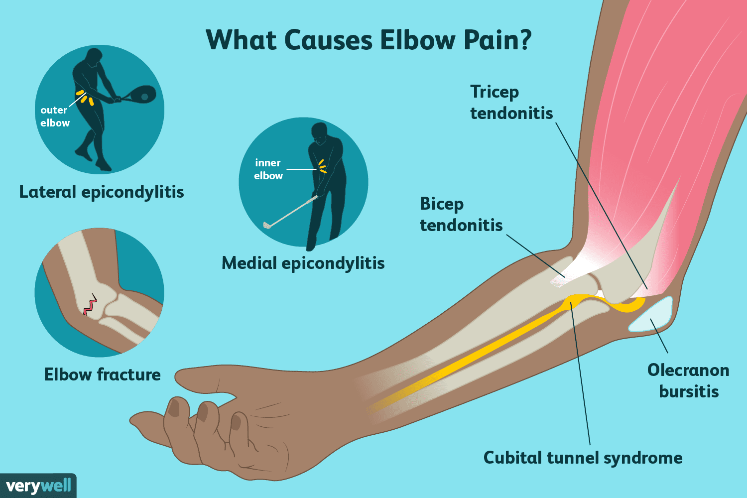 Singapore Elbow Injury Specialist Singapore Sports And Orthopaedic 