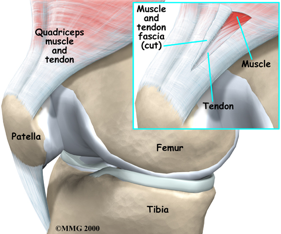 Knee Injury Specialist